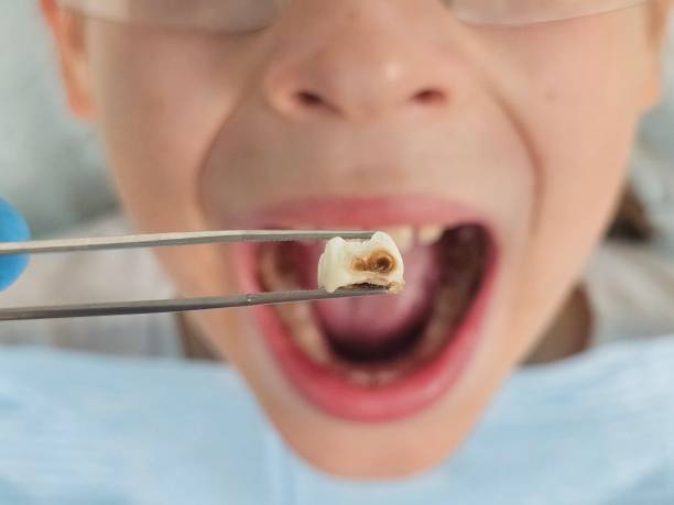 Best Urgent Tooth Repair  in Arial, SC